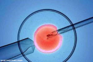 单身生子助孕机构